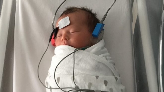 Newborn hearing test
